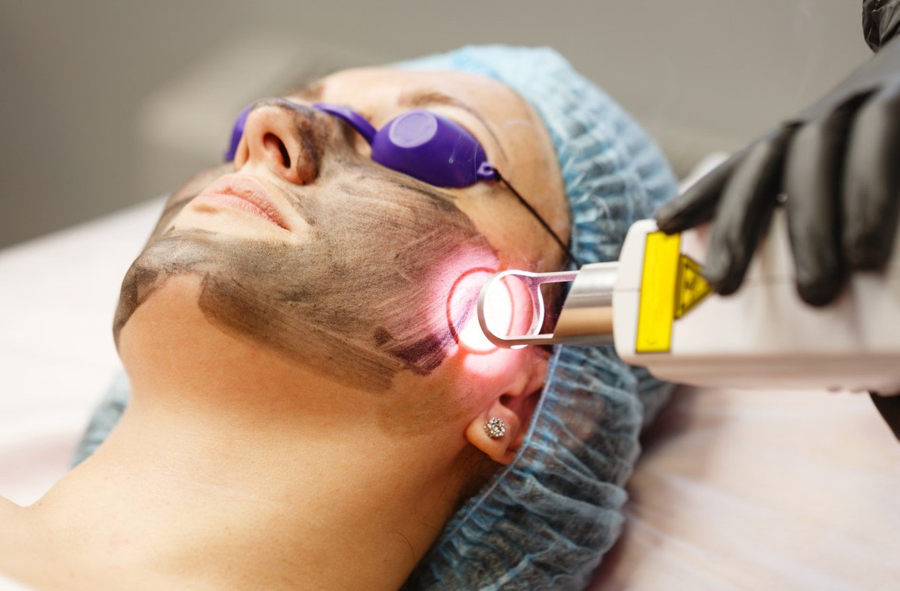 Pigmentation and laser toning treatment preview