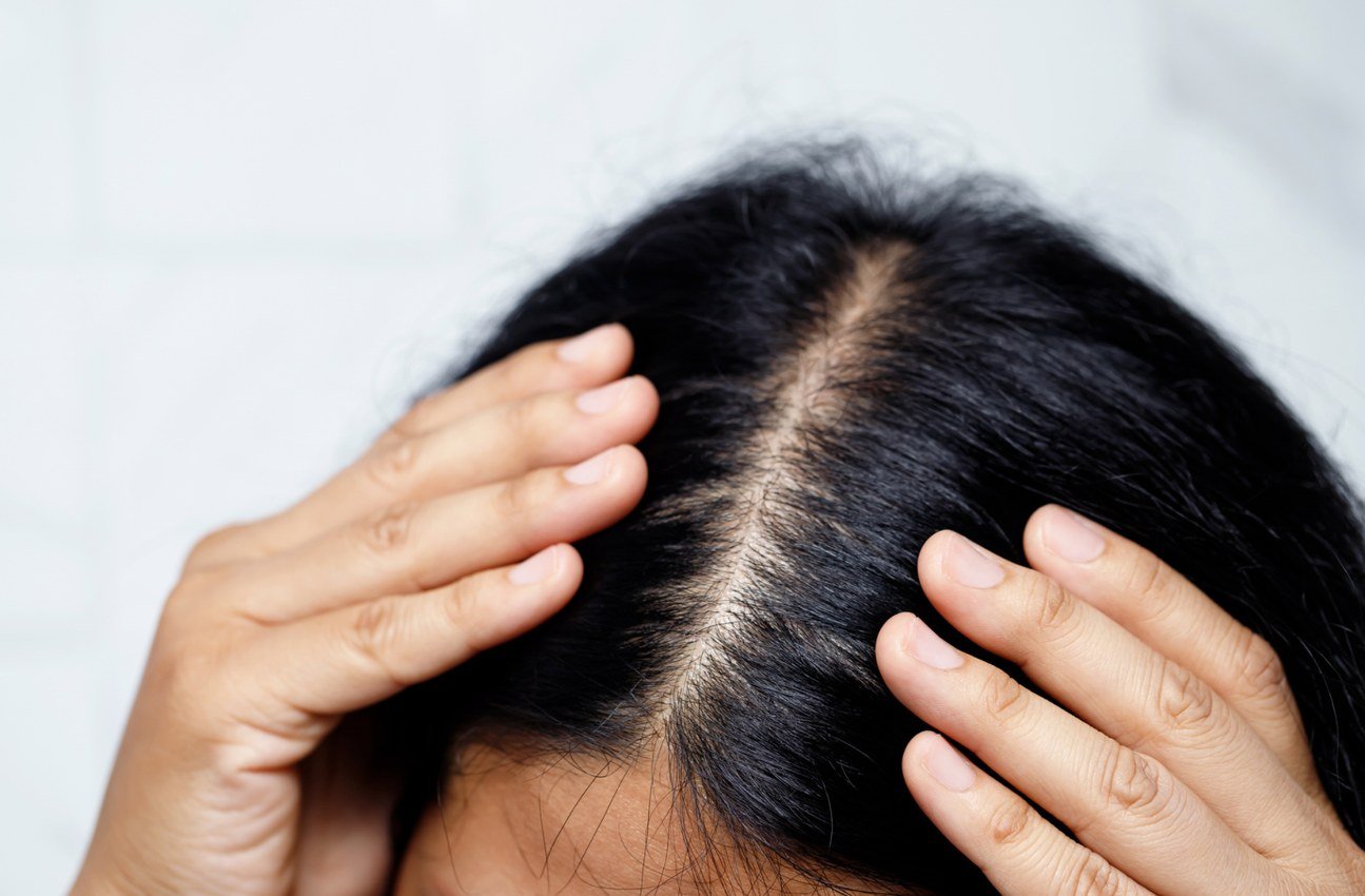 Hair fall scalp and GFC treatment preview